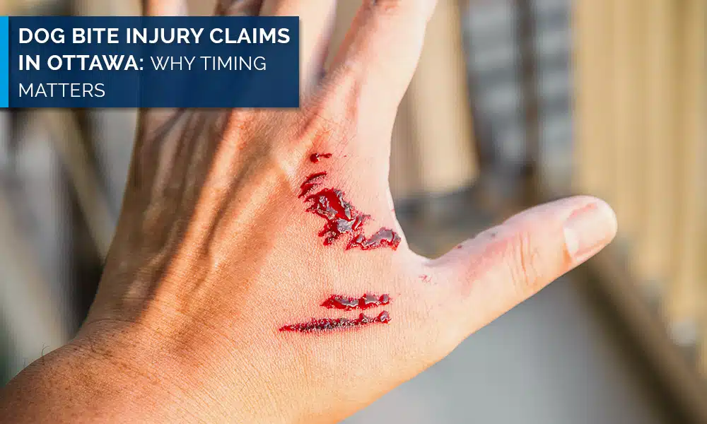 Dog Bite Injury Claims in Ottawa